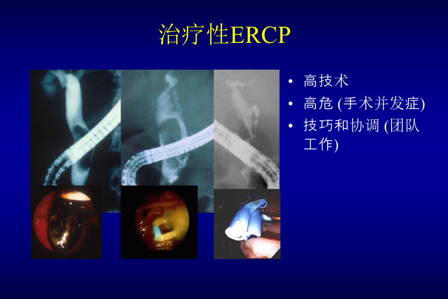 梁永昌ERCP规范化培训课件.ppt_第2页