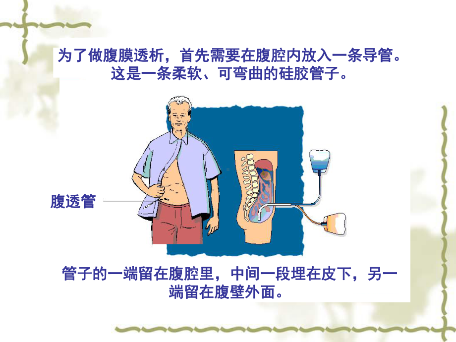 腹膜透析患者教育课件.ppt_第3页