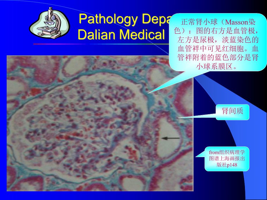 病理学课件 第十章泌尿系统疾病.ppt_第3页