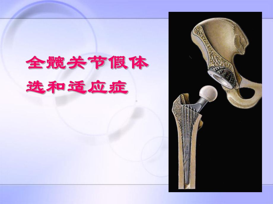 全髋假体选择和适应症课件.ppt_第1页