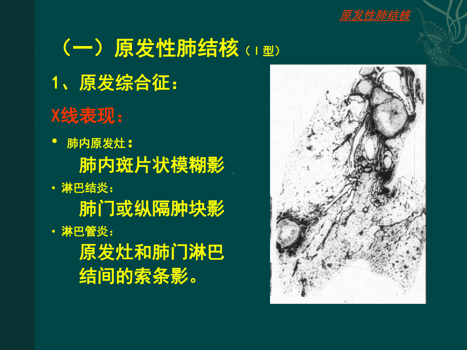 肺结核肺肿瘤课件.ppt_第3页