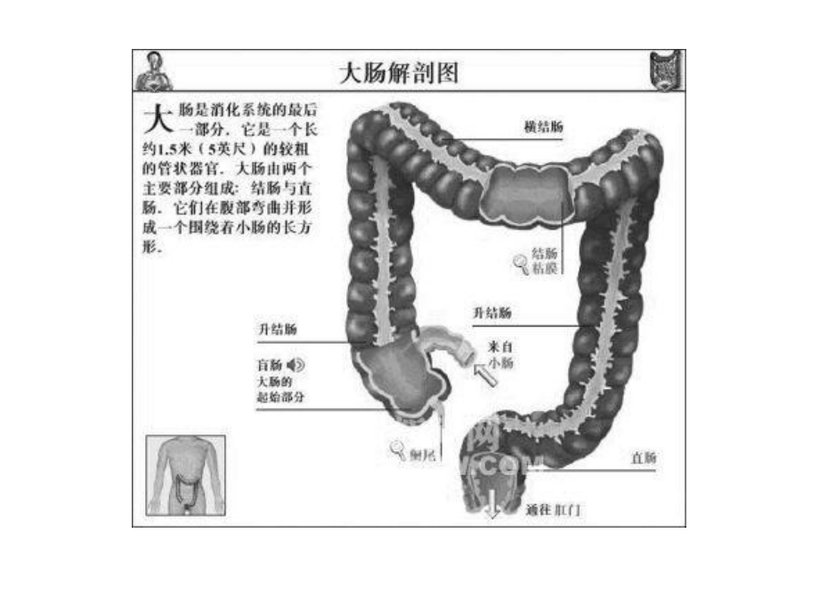 结肠息肉 课件.ppt_第2页