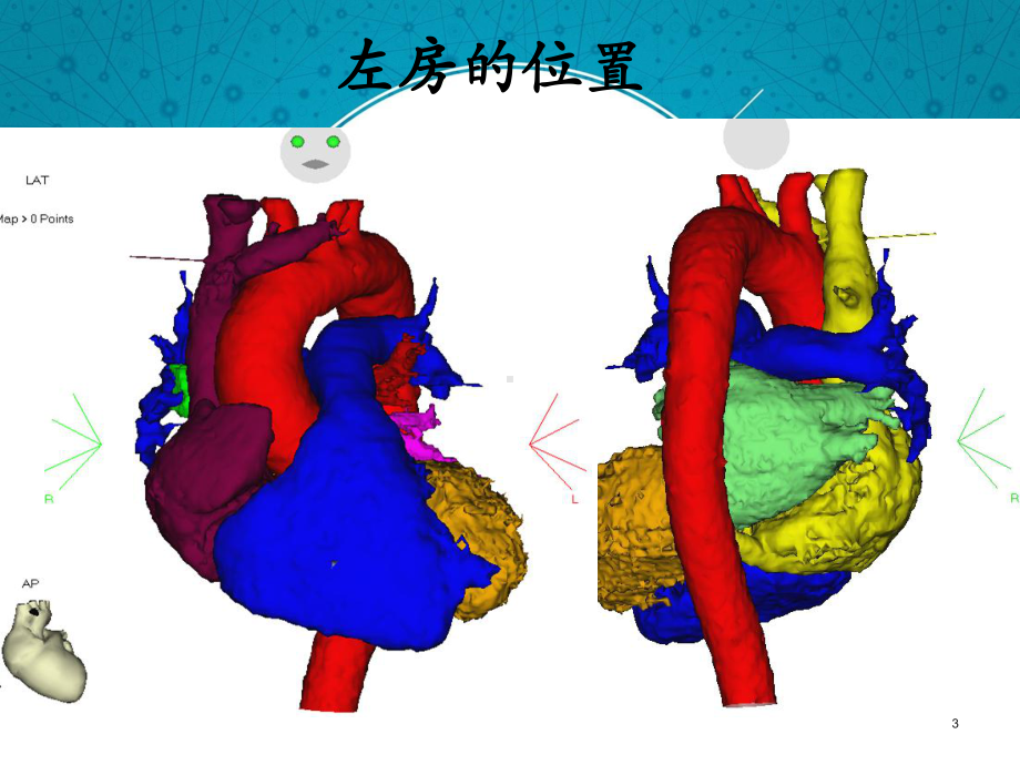 左房标测和消融课件.ppt_第3页