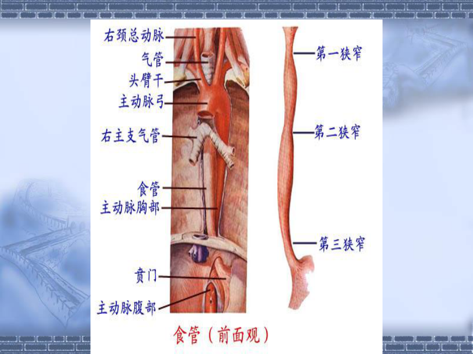 爱爱医资源食管癌的围手术期护理课件.ppt_第3页