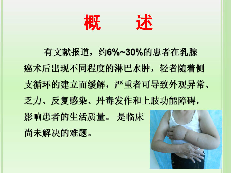 乳腺癌淋巴水肿的预防和治疗课件.ppt_第3页