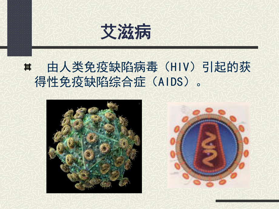 获得性免疫缺陷综合症38课件.ppt_第2页