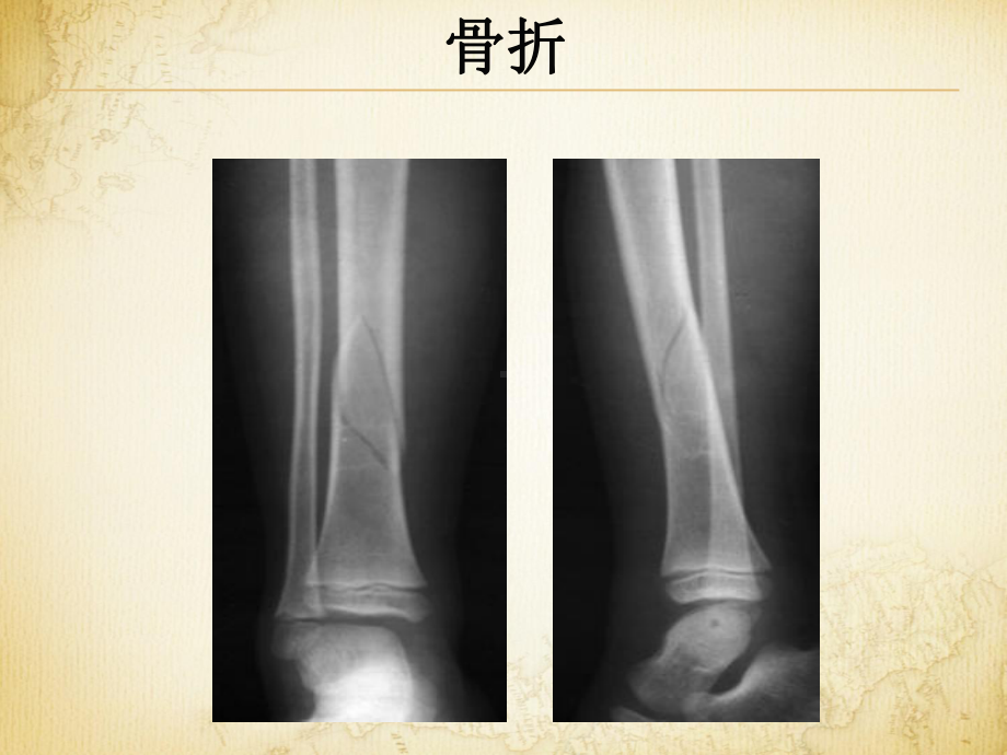 第一章医学影像成像概论课件.ppt_第2页