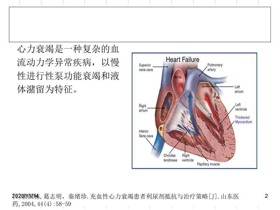 心力衰竭患者利尿剂抵抗与治疗策略修改课件.ppt_第2页