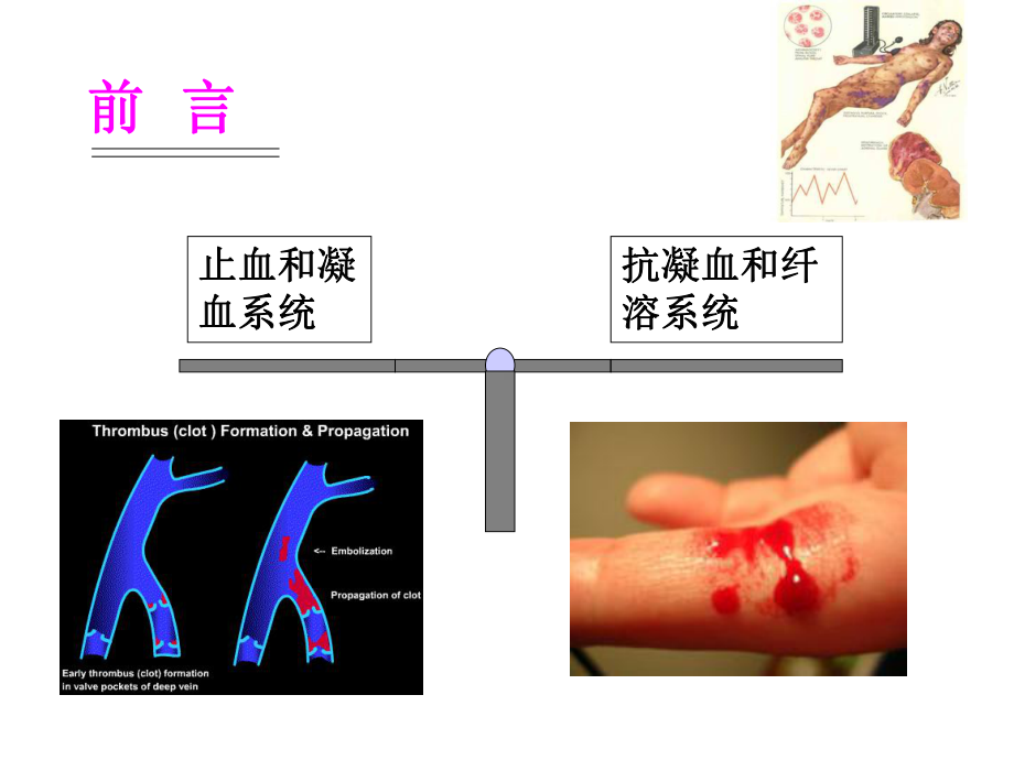 诊断学教学（温州医科大学）出血、血栓与止血检测2015朱课件.ppt_第2页