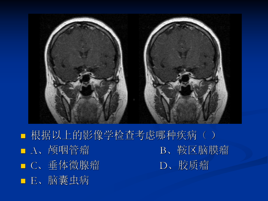 医学影像学读片实训课件.ppt_第3页