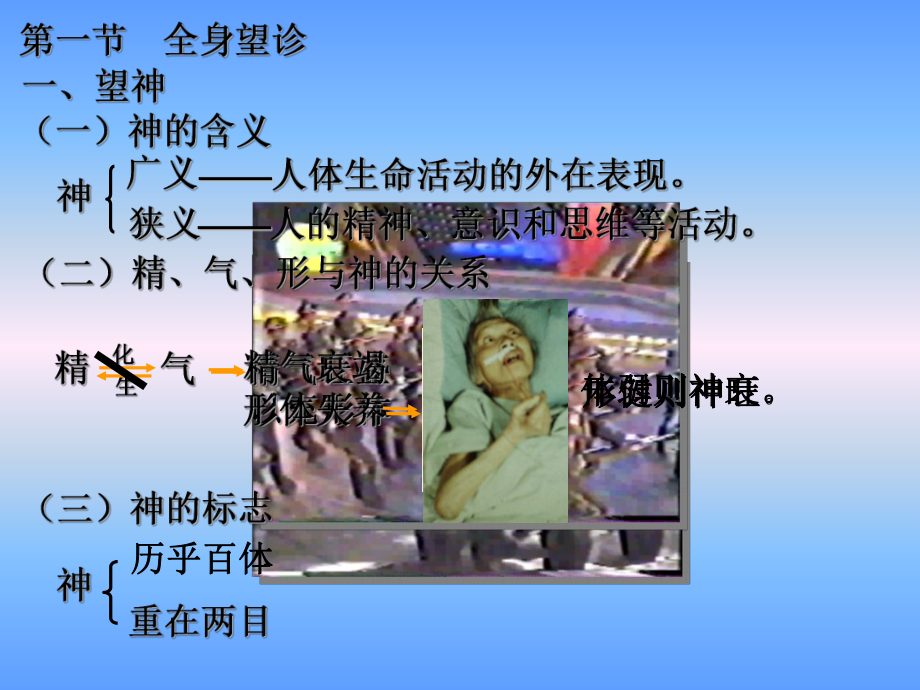 望诊全身课件.ppt_第3页