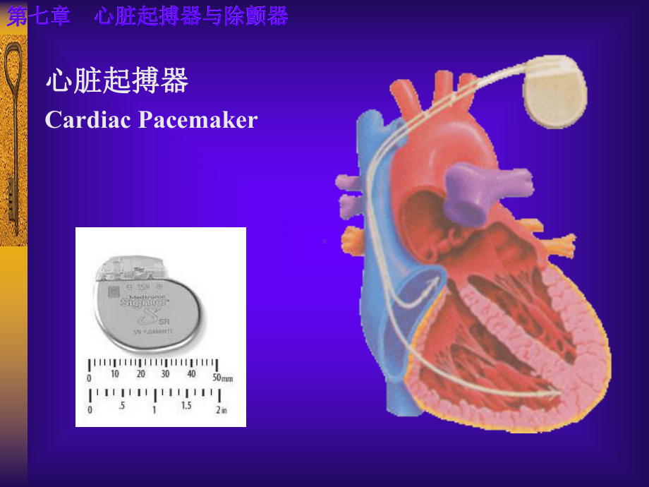 心脏起搏器与除颤器课件.ppt_第2页