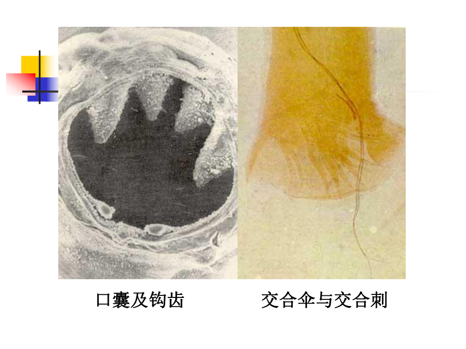 线虫概论、蛔虫、鞭虫课件讲义.ppt_第2页