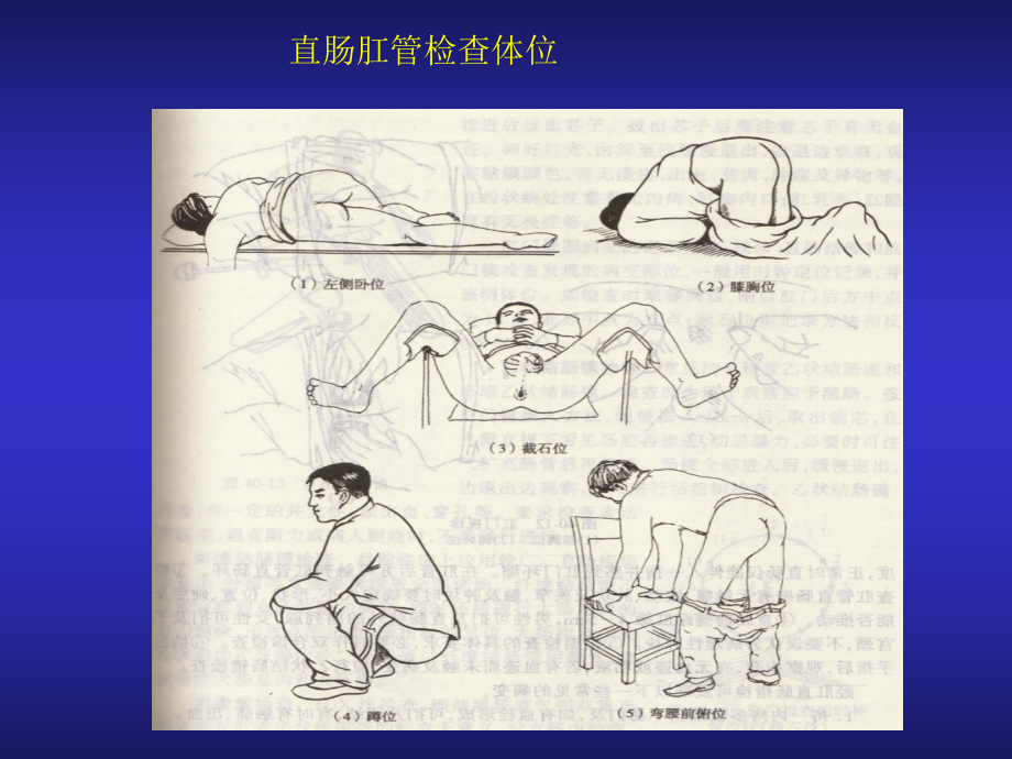 结、直肠与肛门疾病疾病上海第二医科大学[最新]课件.ppt_第2页