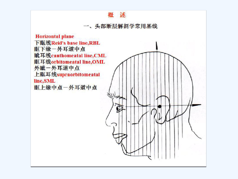 头颅MRI断层解剖课件.ppt_第2页