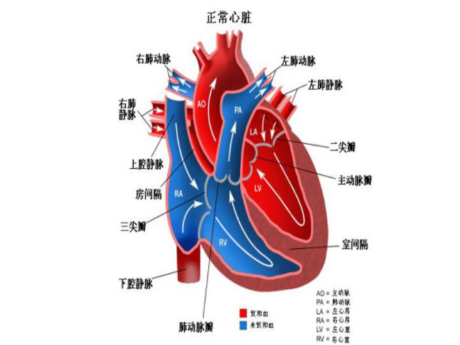 常见先心病解剖图片课件.ppt_第2页