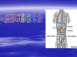 临床执业(助理)医师实践技能考试CT诊断学部份课件.ppt