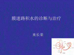 膜迷路积水诊断课件.ppt