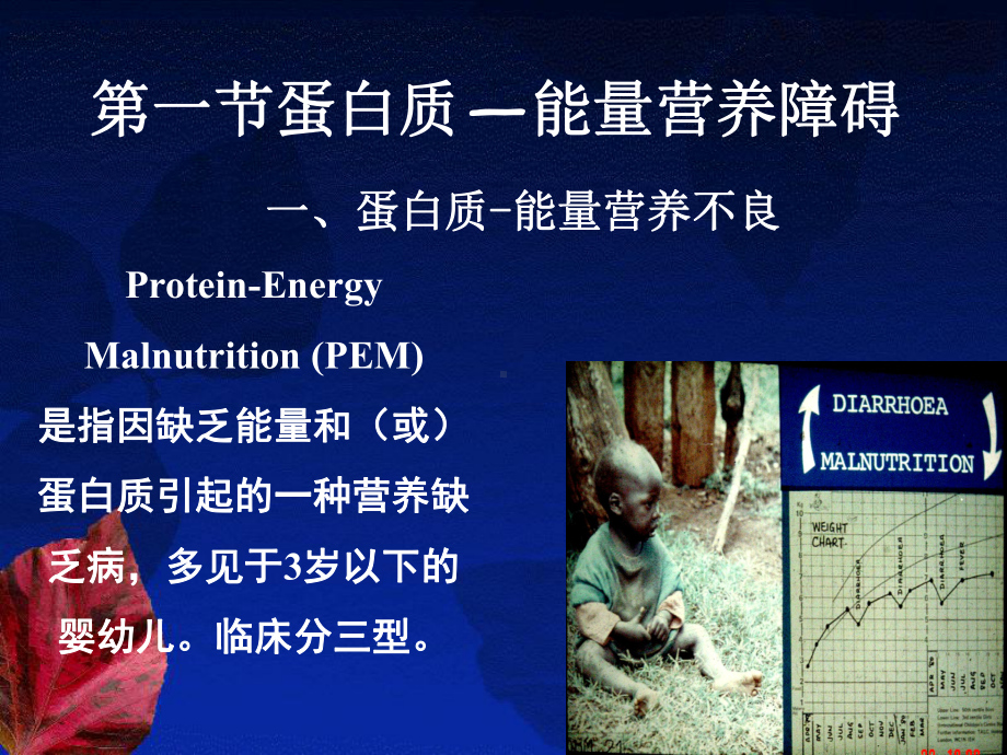 第七章营养障碍疾病患儿的课件.ppt_第2页