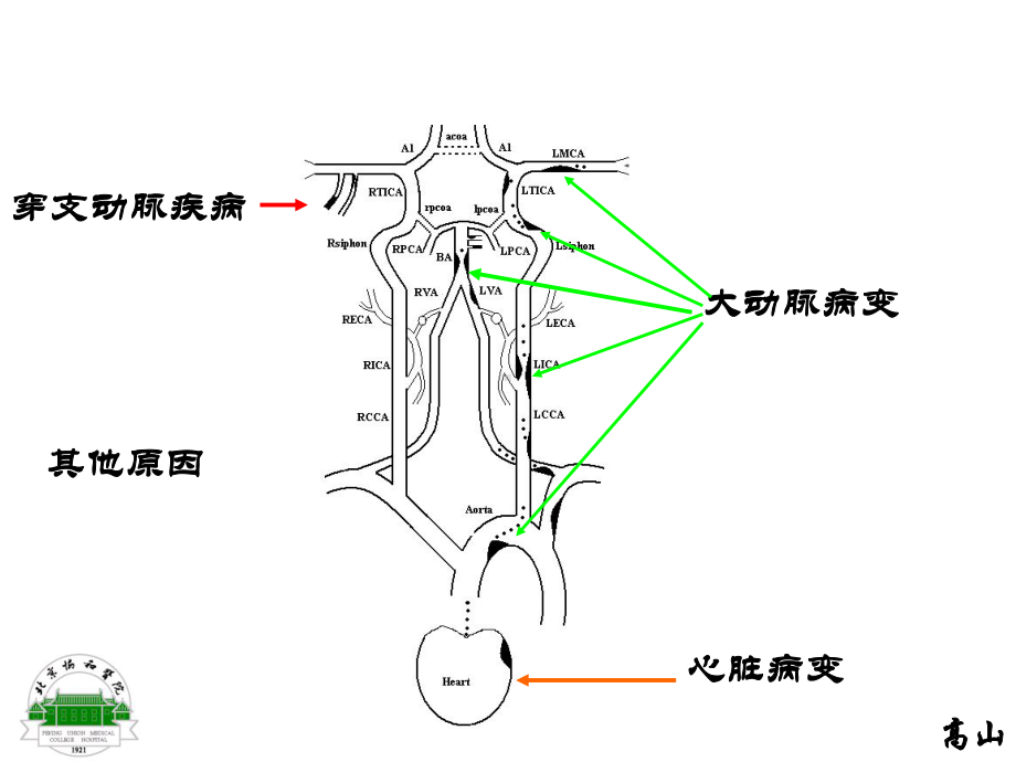 缺血性卒中的病理生理机制上传论坛课件.ppt_第2页