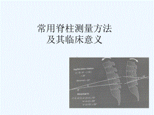 常用脊柱测量方法及其临床意义课件.ppt