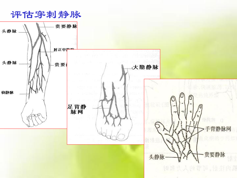 密闭式静脉输液法(同名663)课件.ppt_第3页