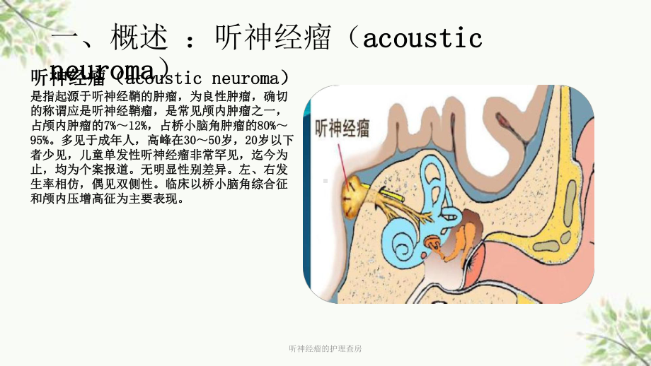 听神经瘤的护理查房课件.ppt_第3页