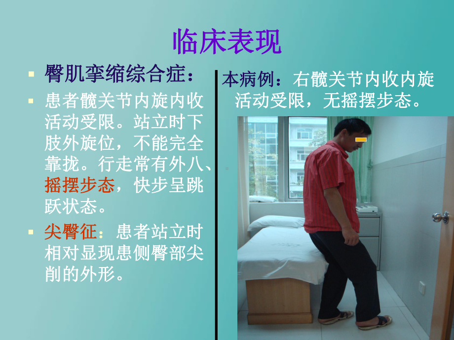 臀肌挛缩综合症 课件.ppt_第3页