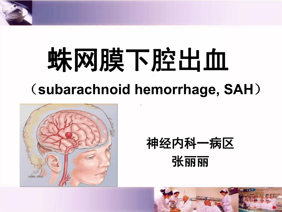 蛛网膜下腔出血医学课件.ppt_第1页