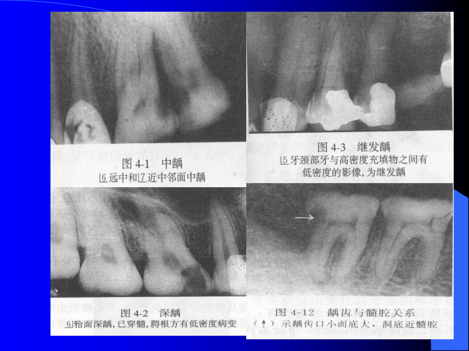 口腔影像学课件.ppt_第3页