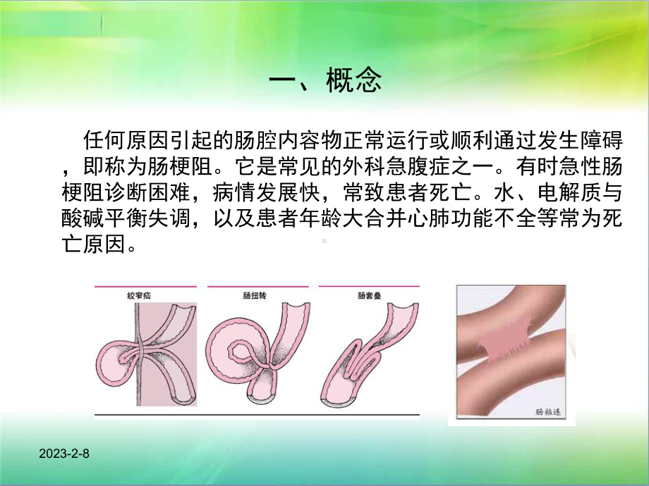 肠梗阻护理常规课件.ppt_第2页