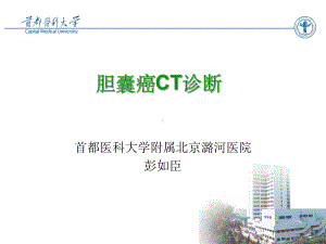 胆囊癌CT诊断课件.ppt