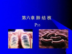 课件第六章 肺结核.ppt