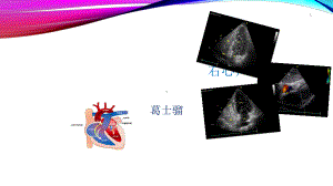 右心声学造影教学课件.ppt