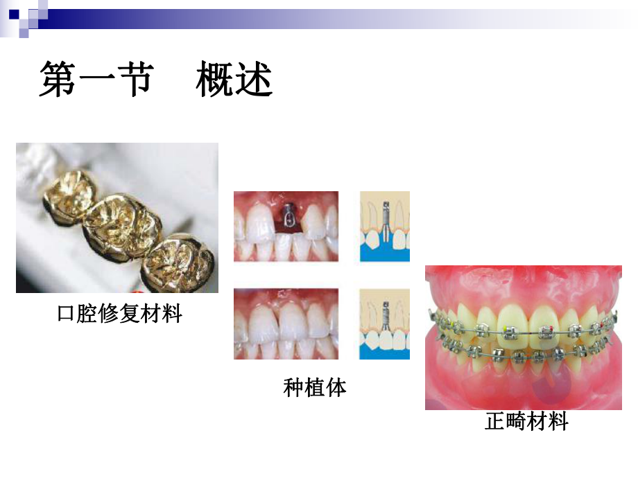 口腔修复材料金属材料课件.ppt_第2页