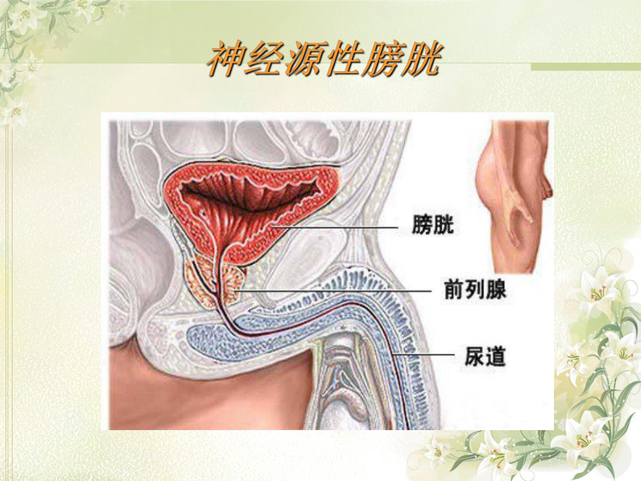 膀胱功能障碍评估课件.ppt_第2页