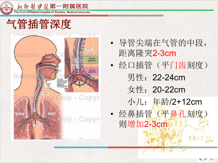 气管插管内吸痰技术完整版课件.pptx_第2页