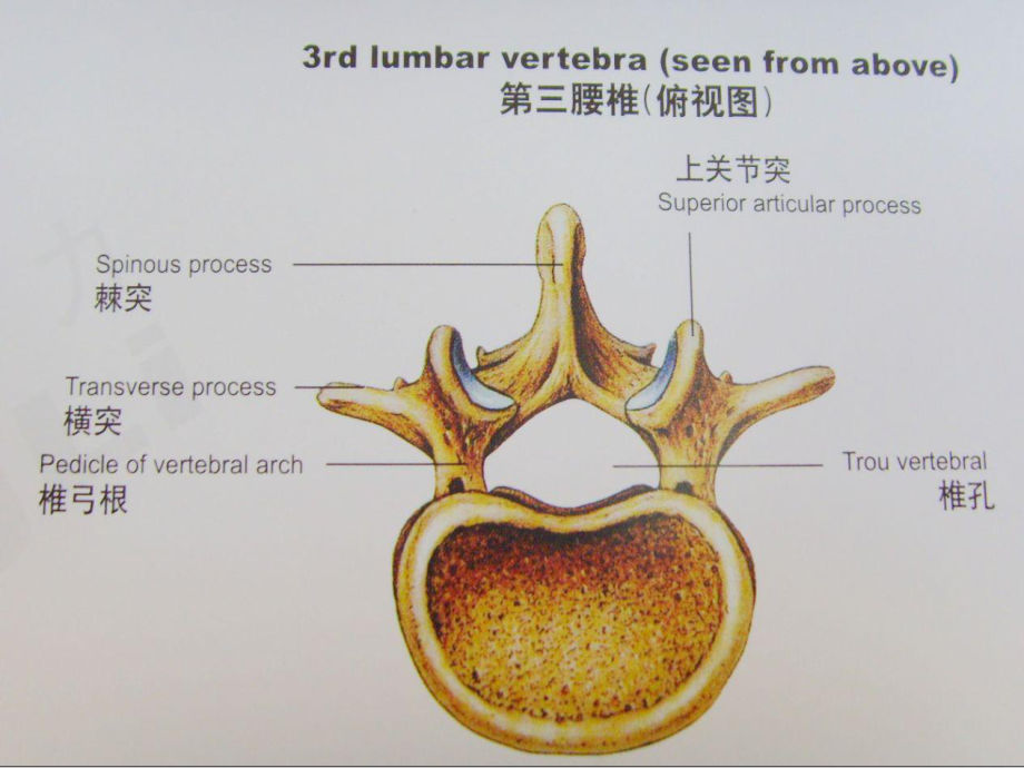 第三腰椎横突综合征的诊疗邹季课件.ppt_第3页