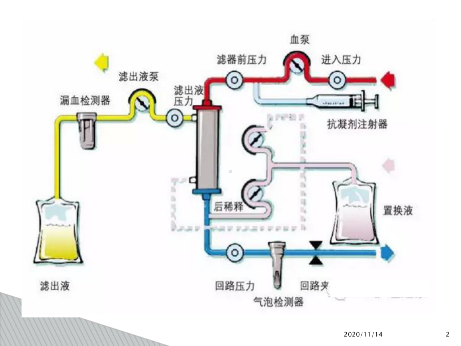 血液透析护理操作过程中风险管理课件.ppt_第2页