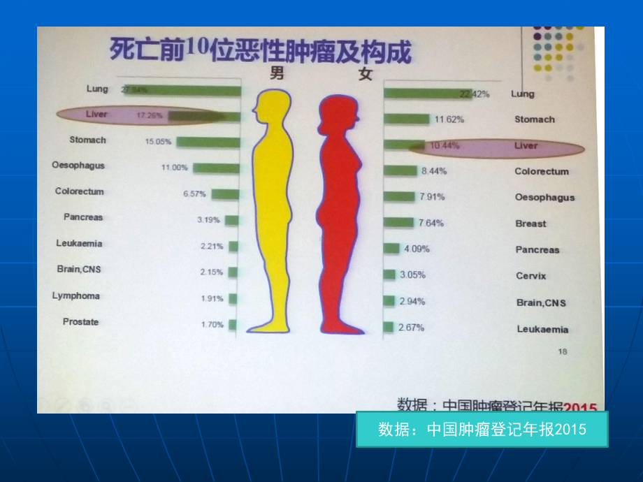 吕维富肝癌tace规范安徽省县级公立医院临床路径网 课件.ppt_第3页