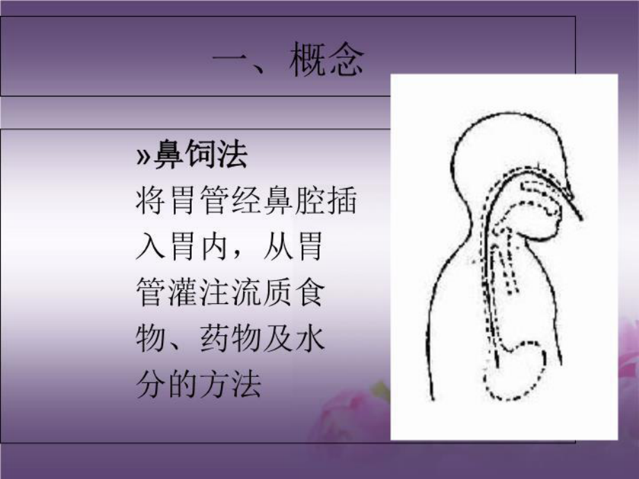 最新版鼻饲法操作课件.ppt_第3页