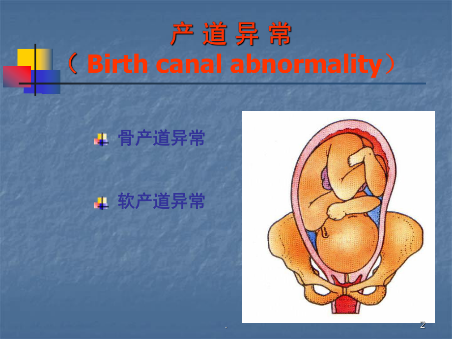 产道异常最新教学课件.ppt_第2页