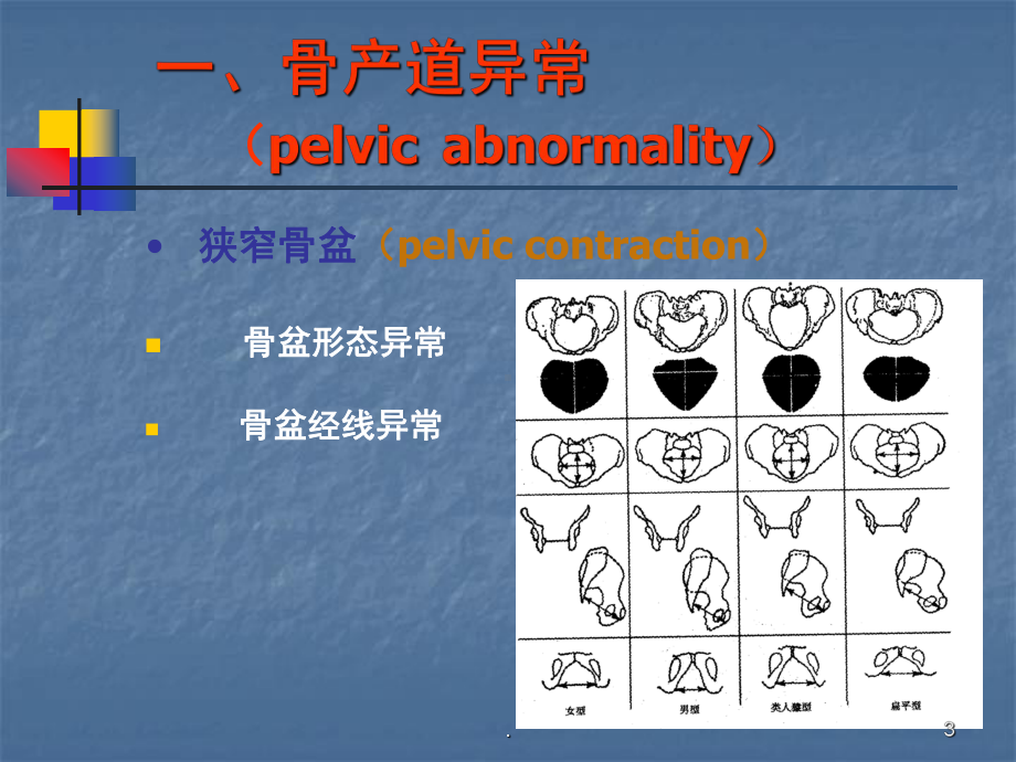 产道异常最新教学课件.ppt_第3页