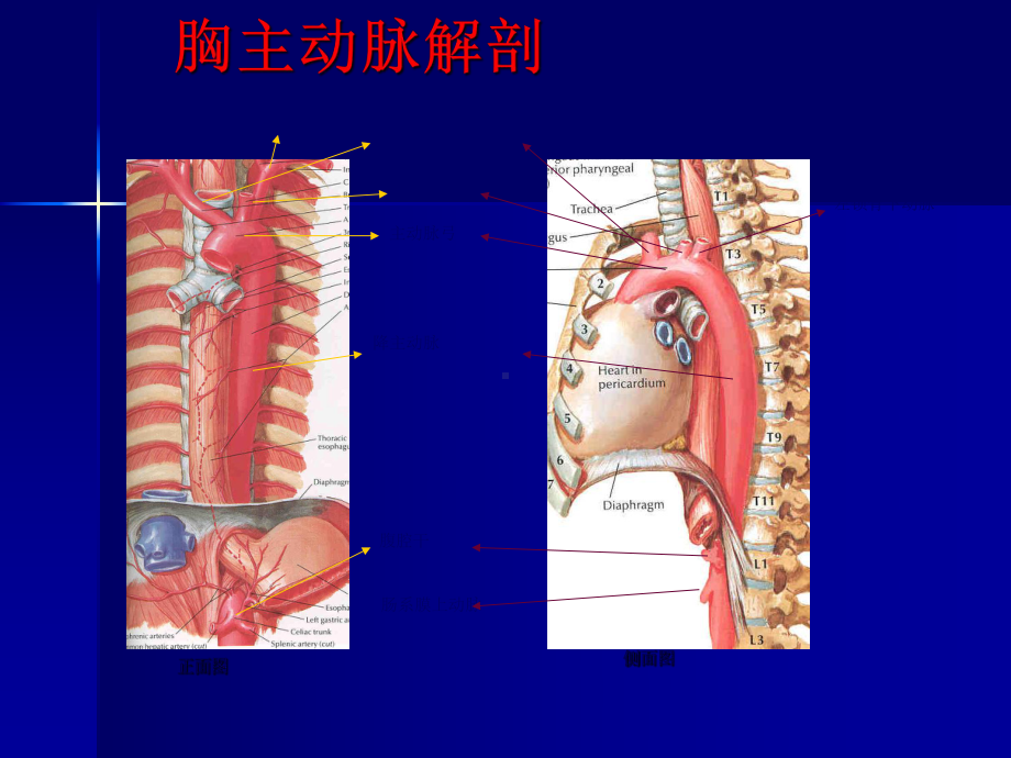 主动脉夹层及腹主动脉瘤CTA影像课件1.ppt_第2页