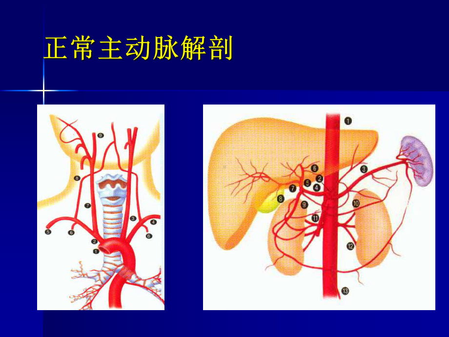 主动脉夹层及腹主动脉瘤CTA影像课件1.ppt_第3页