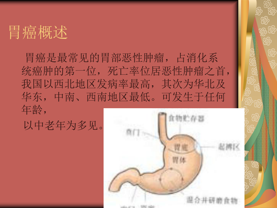 胃癌的护理查房67137课件.ppt_第1页