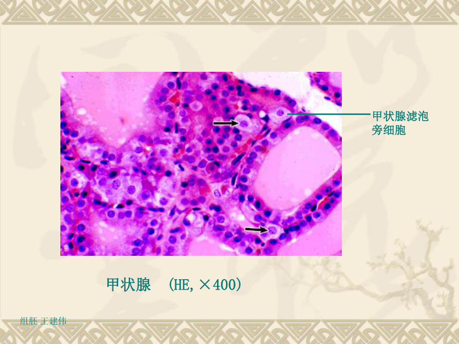 医学组织胚胎学课件内分泌系统.ppt_第3页