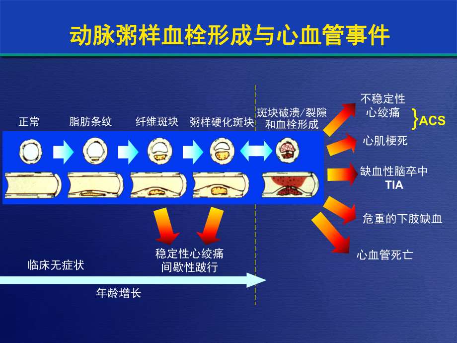 低分子肝素抗凝治疗在ACS中的应用课件.ppt_第2页