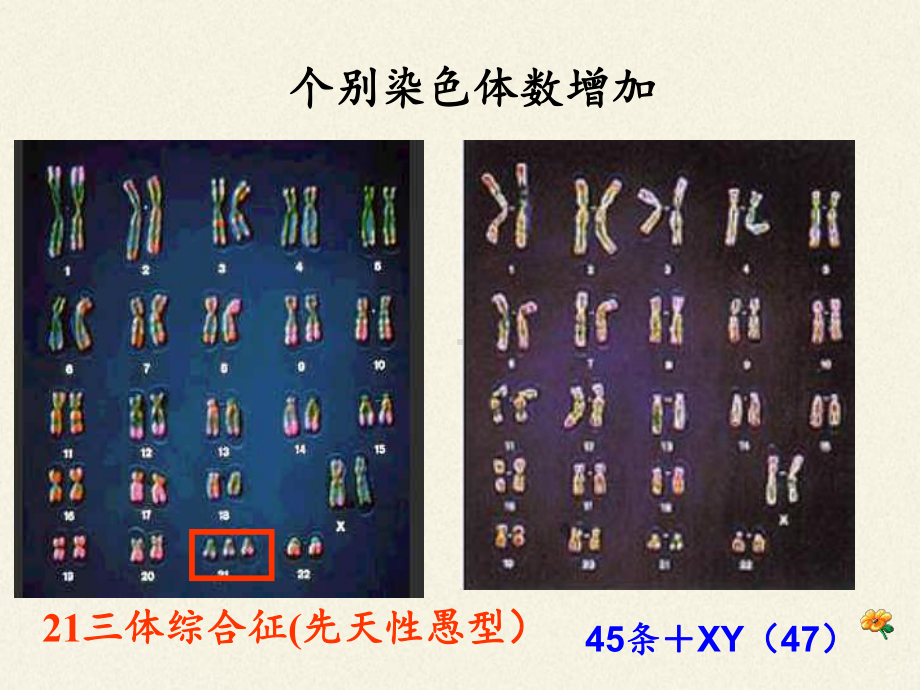 浙教版高中生物必修染色体畸变可能引起性状改变课件.pptx_第3页