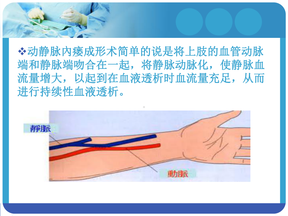 动静脉内瘘护理查房课件.pptx_第2页